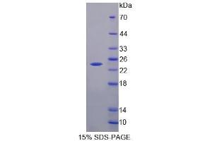 SDS-PAGE analysis of Human HPCAL4 Protein. (HPCAL4 Protein)