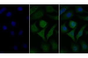 Detection of GLa in Human Hela cell using Polyclonal Antibody to Galactosidase Alpha (GLa) (GLA antibody  (AA 1-80))