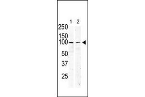 Image no. 1 for anti-Mast/stem Cell Growth Factor Receptor (KIT) (N-Term) antibody (ABIN359890) (KIT antibody  (N-Term))