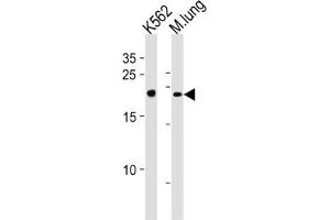 Western Blotting (WB) image for anti-Core-Binding Factor, beta Subunit (CBFB) antibody (ABIN3002868)