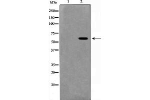 Western blot analysis on HeLa cell lysate using MUTYH Antibody,The lane on the left is treated with the antigen-specific peptide. (MUTYH antibody  (Internal Region))