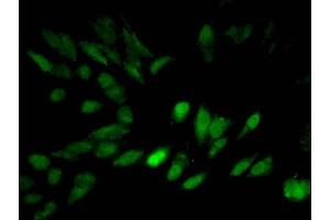 Immunofluorescent analysis of Hela cells using ABIN7139667 at dilution of 1:100 and Alexa Fluor 488-congugated AffiniPure Goat Anti-Rabbit IgG(H+L) (HIST1H3A antibody  (3meLys27))