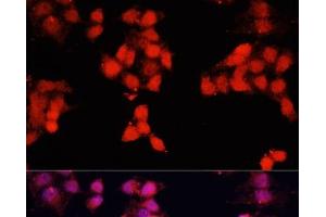 Immunofluorescence analysis of HeLa cells using ENO3 Polyclonal Antibody at dilution of 1:100. (ENO3 antibody)