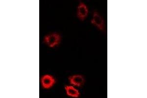 Immunofluorescent analysis of HIWI1 staining in U2OS cells. (PIWIL1 antibody)