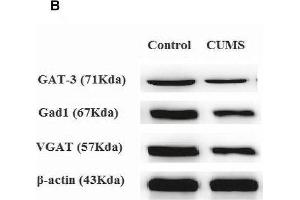 Chronic unpredictable mild stress (CUMS) exposures decrease GABAergic neuron-associated gene/protein expression level in the NAc tissue. (SLC32A1 antibody)