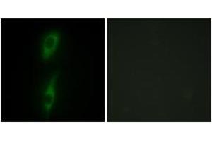 Immunofluorescence analysis of HeLa cells, using ACVL1 Antibody. (ACVRL1 antibody  (AA 196-245))
