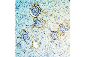 IHC analysis of ANXA3 using anti-ANXA3 antibody (ABIN6719269). (Annexin A3 antibody  (AA 23-323))