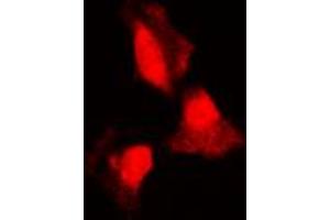 Immunofluorescence (IF) image for anti-serum/glucocorticoid Regulated Kinase 1 (SGK1) (Center) antibody (ABIN7301276)