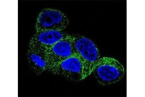 Confocal immunofluorescent analysis of b-Tubulin antibody with HepG2 cells followed by Alexa Fluor 488-conjugated goat anti-mouse lgG (green). (TUBB1 antibody)