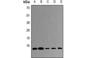 Western blot analysis of UBE2D4 expression in HepG2 (A), MCF7 (B), mouse liver (C), mouse kidney (D), rat lung (E) whole cell lysates. (UBE2D4 antibody)