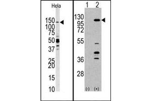 Image no. 1 for anti-Phosphoinositide-3-Kinase, Catalytic, gamma Polypeptide (PIK3CG) (C-Term) antibody (ABIN360712)