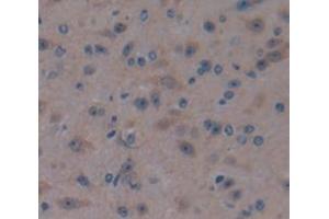 Used in DAB staining on fromalin fixed paraffin- embedded Kidney tissue (CRYGS antibody  (AA 2-178))