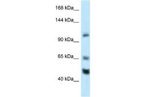 WB Suggested Anti-Rest Antibody Titration: 1. (REST antibody  (Middle Region))