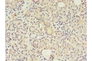 Immunohistochemistry of paraffin-embedded human pancreatic tissue using ABIN7144550 at dilution of 1:100 (GIT2 antibody  (AA 1-603))