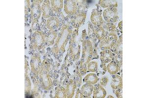 Immunohistochemistry of paraffin-embedded rat kidney using PDGFB Antibody (ABIN1874072) at dilution of 1:100 (40x lens).