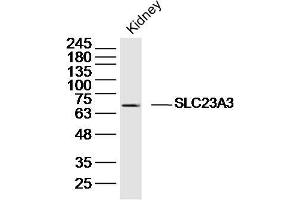 Mouse kidney lysates probed with SLC23A3 Polyclonal Antibody, Unconjugated  at 1:300 dilution and 4˚C overnight incubation. (SLC23A3 antibody  (AA 201-300))