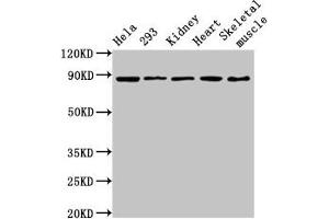 Western Blot Positive WB detected in: Hela whole cell lysate, 293 whole cell lysate, Rat kidney tissue, Mouse heart tissue, Mouse skeletal muscle tissue All lanes: SEMA3A antibody at 3. (SEMA3A antibody  (AA 357-445))