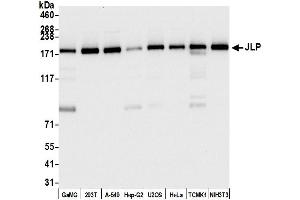 Western Blotting (WB) image for anti-Sperm Associated Antigen 9 (SPAG9) (AA 1-50) antibody (ABIN7454611)