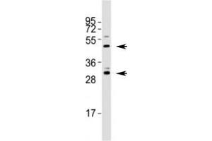 Western blot testing of Shh antibody at 1:1000 dilution + mouse stomach lysate; Predicted molecular weight: 45/27/19 kDa (1) (Sonic Hedgehog antibody  (C-Term))