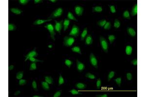 Immunofluorescence of monoclonal antibody to SH2D4A on HeLa cell. (SH2D4A antibody  (AA 239-338))