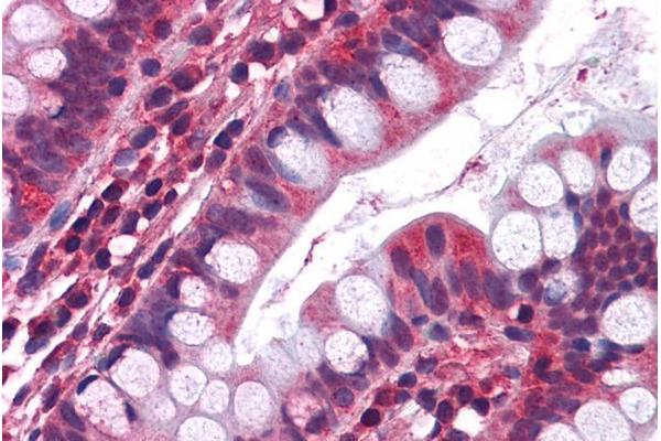 Serotonin Receptor 3A antibody  (Internal Region)