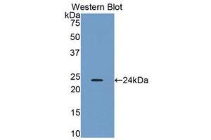 Western Blotting (WB) image for anti-Orosomucoid 2 (ORM2) (AA 19-201) antibody (ABIN1078413) (Orosomucoid 2 antibody  (AA 19-201))