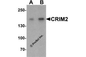 Western Blotting (WB) image for anti-Kielin/Chordin-Like Protein (KCP) (C-Term) antibody (ABIN1030344) (KCP antibody  (C-Term))