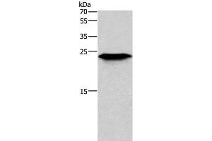 Western Blot analysis of Mouse skeletal muscle tissue using CD269 Polyclonal Antibody at dilution of 1:200 (BCMA antibody)