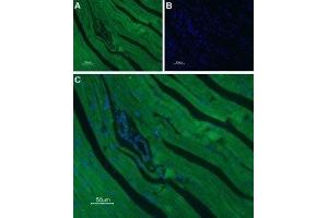 Immunohistochemistry (IHC) image for anti-Calcium Channel, Voltage-Dependent, L Type, alpha 1C Subunit (CACNA1C) (AA 848-865), (Intracellular) antibody (ABIN7043000)