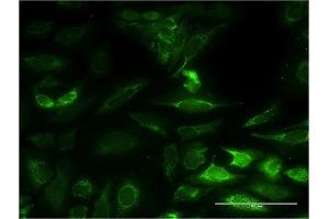 Immunofluorescence of monoclonal antibody to NT5M on HeLa cell. (NT5M antibody  (AA 129-228))