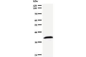 Western Blotting (WB) image for anti-Tyrosyl-tRNA Synthetase (Yars) antibody (ABIN933090) (YARS antibody)