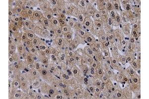 Immunohistochemical staining of paraffin-embedded Human liver tissue using anti-VWA5A mouse monoclonal antibody. (VWA5A antibody)
