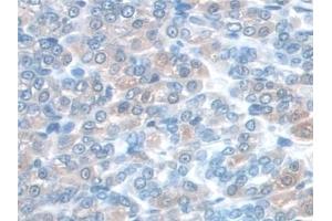 Immunohistochemistry (IHC) image for anti-Synaptosomal-Associated Protein, 23kDa (SNAP23) (AA 1-210) antibody (ABIN7444226)