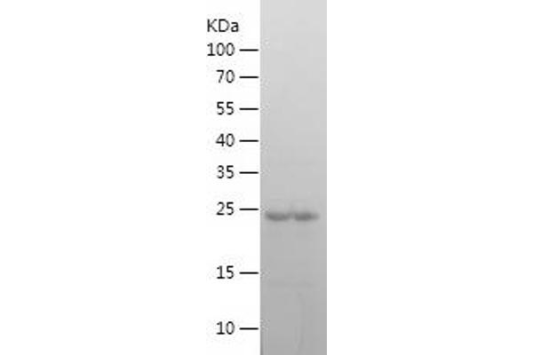 GATA3 Protein (AA 1-209) (His tag)