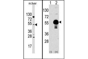 (LEFT)Western blot analysis of anti-AKT2 Antibody (N-term) Pab in mouse liver tissue lysates (35ug/lane).