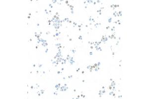 Immunocytochemistry (ICC) image for anti-Twist Homolog 1 (Drosophila) (TWIST1) (AA 1-50) antibody (ABIN7453340) (Recombinant TWIST1 antibody  (AA 1-50))