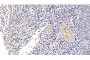 Detection of SDC1 in Human Tonsil Tissue using Monoclonal Antibody to Syndecan 1 (SDC1) (Syndecan 1 antibody  (AA 23-253))