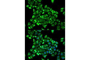 Immunofluorescence analysis of MCF-7 cell using CDA antibody. (CDA antibody  (AA 1-146))
