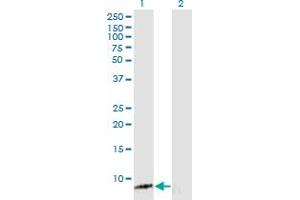 Western Blot analysis of ASXL1 expression in transfected 293T cell line by ASXL1 monoclonal antibody (M05), clone 6E2. (ASXL1 antibody  (AA 1-84))