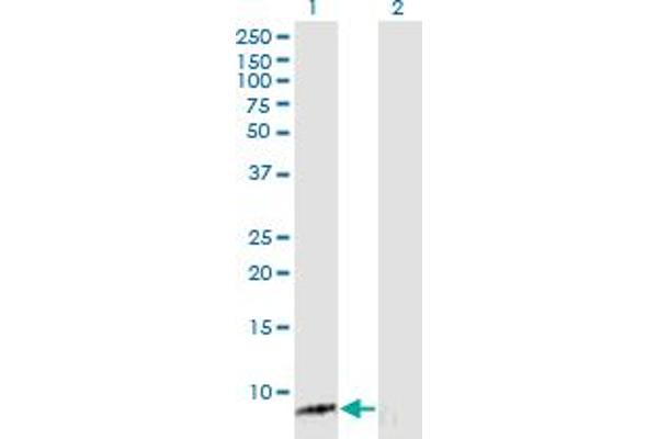 ASXL1 antibody  (AA 1-84)