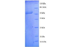 Transgelin (TAGLN) (AA 2-201), (full length) protein (GST tag) (Transgelin Protein (TAGLN) (AA 2-201, full length) (GST tag))