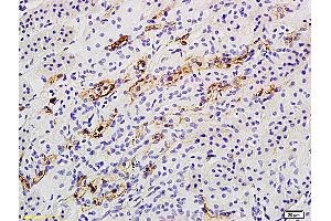 Formalin-fixed and paraffin embedded rat kidney labeled with Anti Catalase Polyclonal Antibody, Unconjugated (ABIN872991) followed by conjugation to the secondary antibody and DAB staining (Catalase antibody  (AA 251-350))