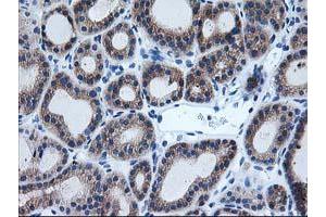 Image no. 3 for anti-Aryl Hydrocarbon Receptor Interacting Protein-Like 1 (AIPL1) antibody (ABIN1496508) (AIPL1 antibody)