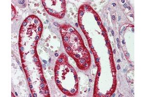 Immunohistochemistry (IHC) image for anti-Eukaryotic Translation Initiation Factor 3 Subunit E (EIF3E) (N-Term) antibody (ABIN2783259) (EIF3E antibody  (N-Term))