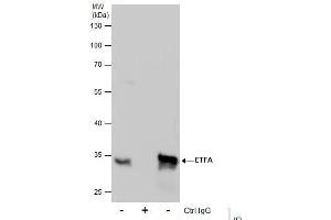 IP Image Immunoprecipitation of ETFA protein from HepG2 whole cell extracts using 5 μg of ETFA antibody, Western blot analysis was performed using ETFA antibody, EasyBlot anti-Rabbit IgG  was used as a secondary reagent. (ETFA antibody  (Center))