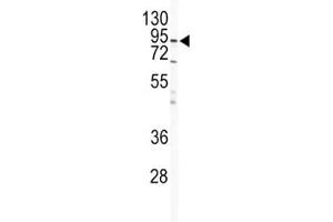 Western blot analysis of IKK beta antibody and HeLa lysate. (IKBKB antibody)