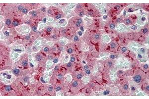 Detection of ABCB11 in Human Liver Tissue using Polyclonal Antibody to ATP Binding Cassette Transporter B11 (ABCB11) (ABCB11 antibody  (AA 421-663))