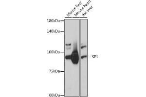 Western blot analysis of extracts of various cell lines, using SP1 antibody (ABIN7270506) at 1:1000 dilution. (SP1 antibody  (AA 420-620))
