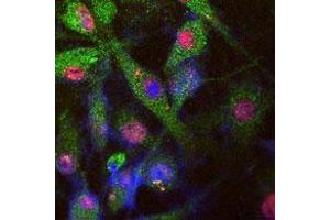 Tau-stable SY5Y cell image stained for endogenous LRRK (green) by Abgent L955a (affinity purified), phosphorylated tau (red, monoclonal AT8) and nuclear staining by DI. (LRRK2 antibody  (AA 930-961))