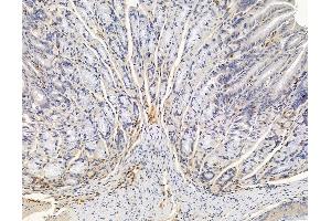 ABIN6265565 and ABIN6278949 at 1/100 staining mouse stomach tissue by IHC-P. (TIAF1 antibody  (C-Term))